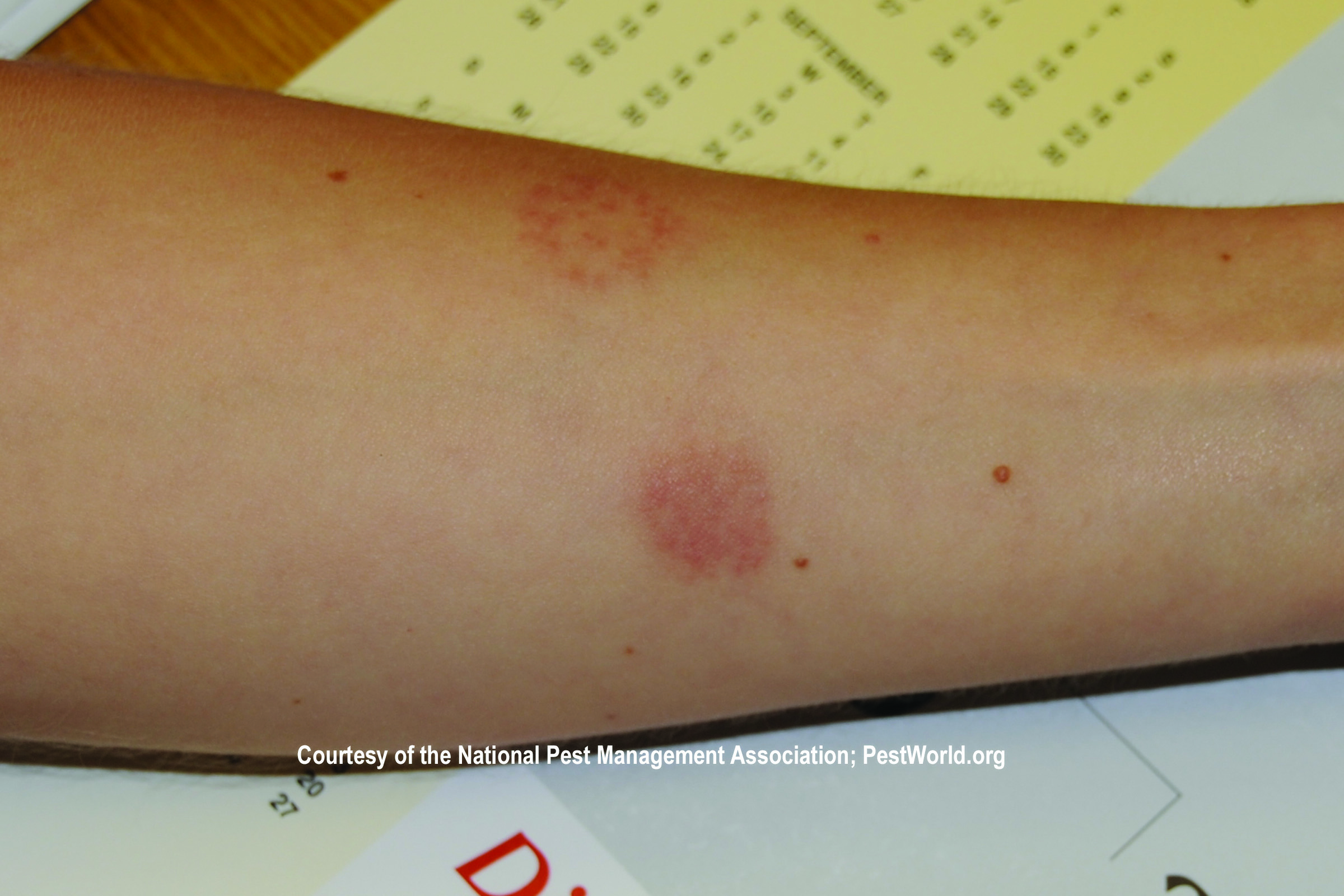 Identify Bed Bugs: How They Start, Where They Come From