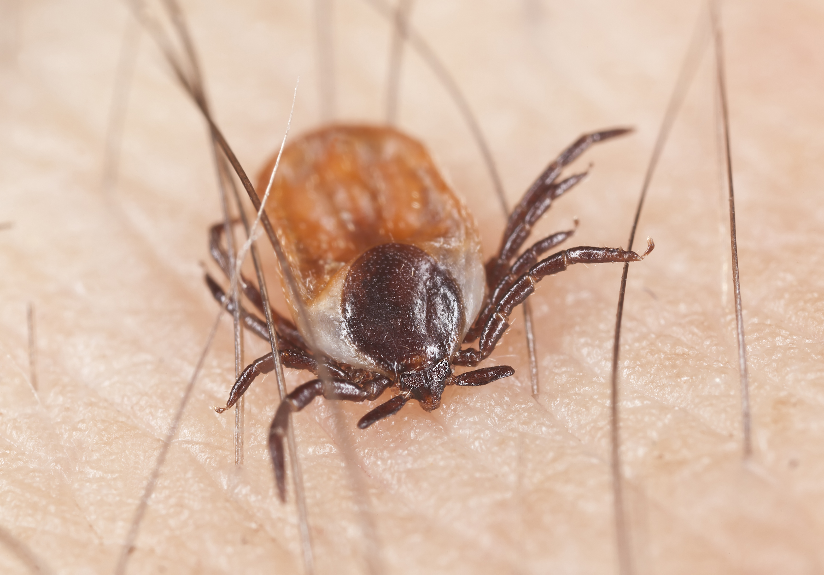 A close-up of a tick on someone's skin