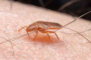 bed bug feeding on skin.jpg