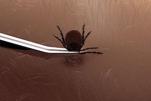 !TICK TWEEZERS.jpg